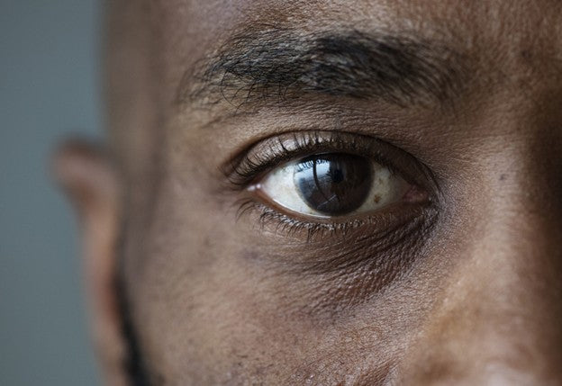 What are Eye Floaters?